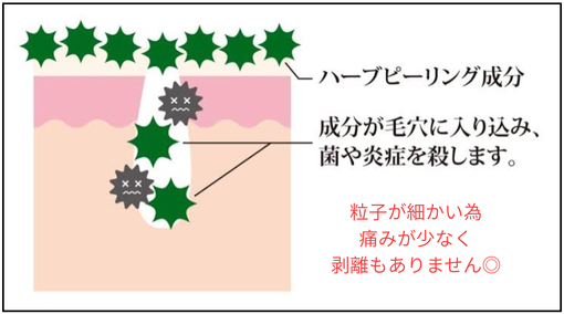 ハーブピーリング